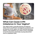 FEMENINE FLORA SUPPORT CAPSULES
